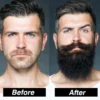 Men's Beard Growth Kit - Professional Enhancer Set