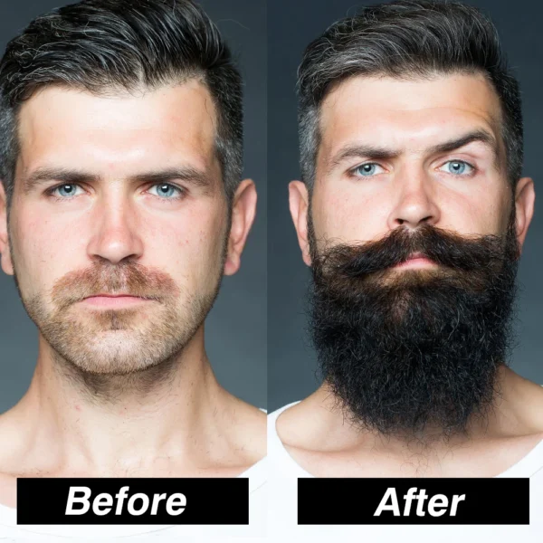 Men's Beard Growth Kit - Professional Enhancer Set