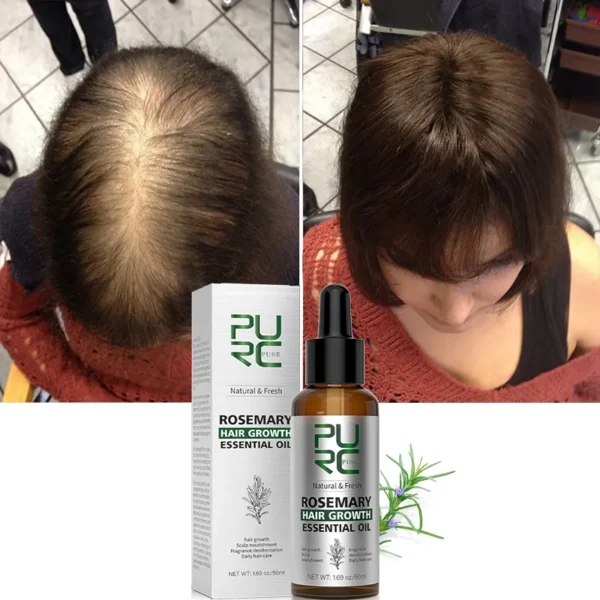 Rosemary Oil Hair Growth Products